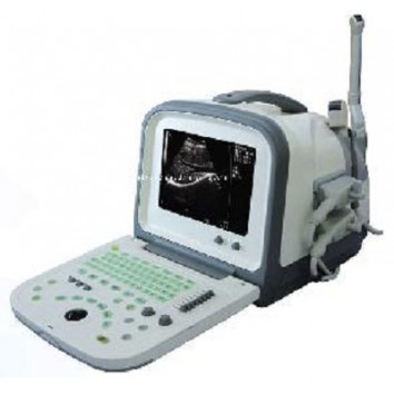 ULTRASOUND DIAGNOSTIC SYSTEM PORTABLE - HY-5511